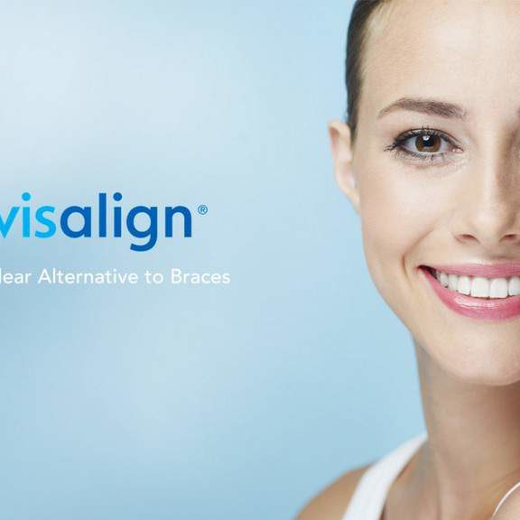invisalign