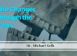 bite changes